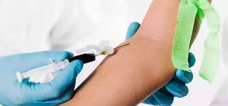 IGRA Blood Test : About IGRA Test & Cost